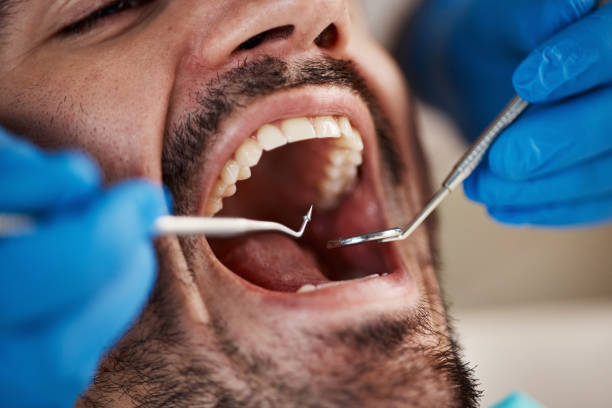 Best Tooth Infection Emergency Dentist  in Ventnor City, NJ